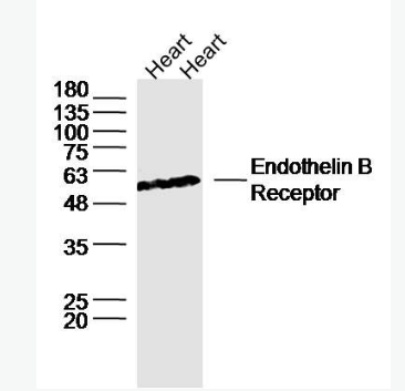 Anti-Endothelin B Receptorantibody -内皮素B受体抗体