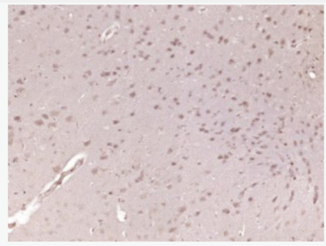 Anti-SMAD1 + SMAD5 antibody -细胞信号转导分子SMAD1 + SMAD5抗体