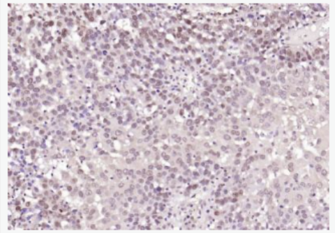 Anti-TRIB3 antibody -神经细胞死亡诱导蛋白激酶抗体