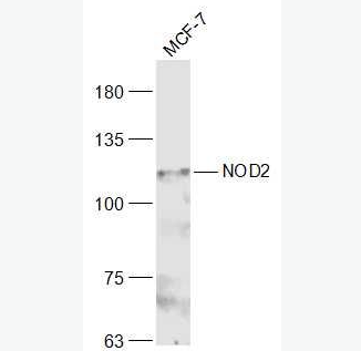 Anti-CARD15/NOD2 antibody -凋亡加强结构域蛋白15抗体