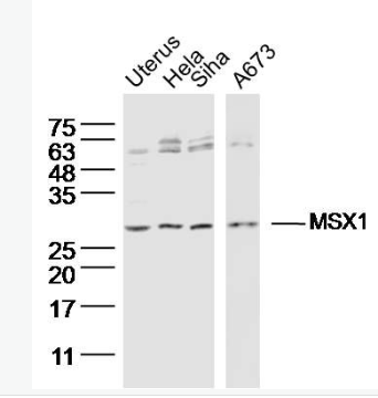Anti-MSX1 antibody -MSH同源蛋白1样蛋白抗体