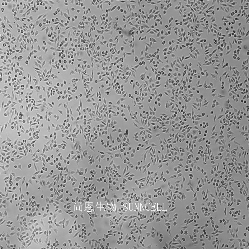 人恶性黑色素瘤细胞