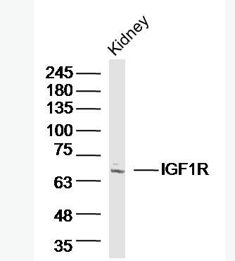 Anti-IGF1R antibody -胰岛素样生长因子1受体抗体