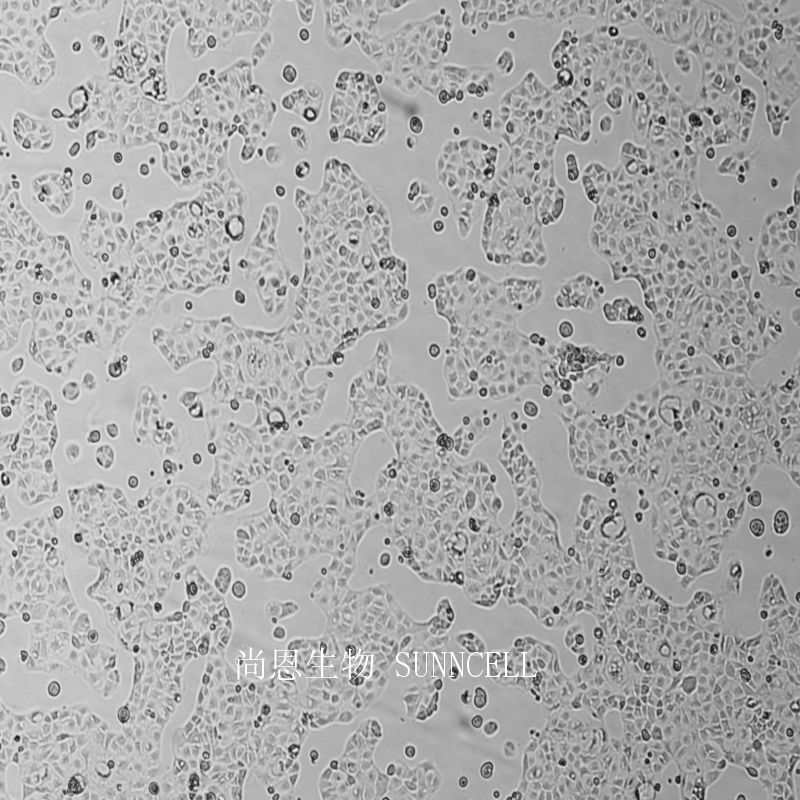 Caco-2人结直肠腺癌细胞