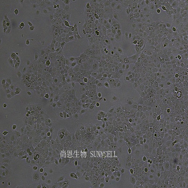 人宫颈癌肠转移细胞