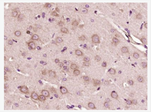 Anti-VWF antibody -血管假性血友病因子/血管性血友病因子抗体