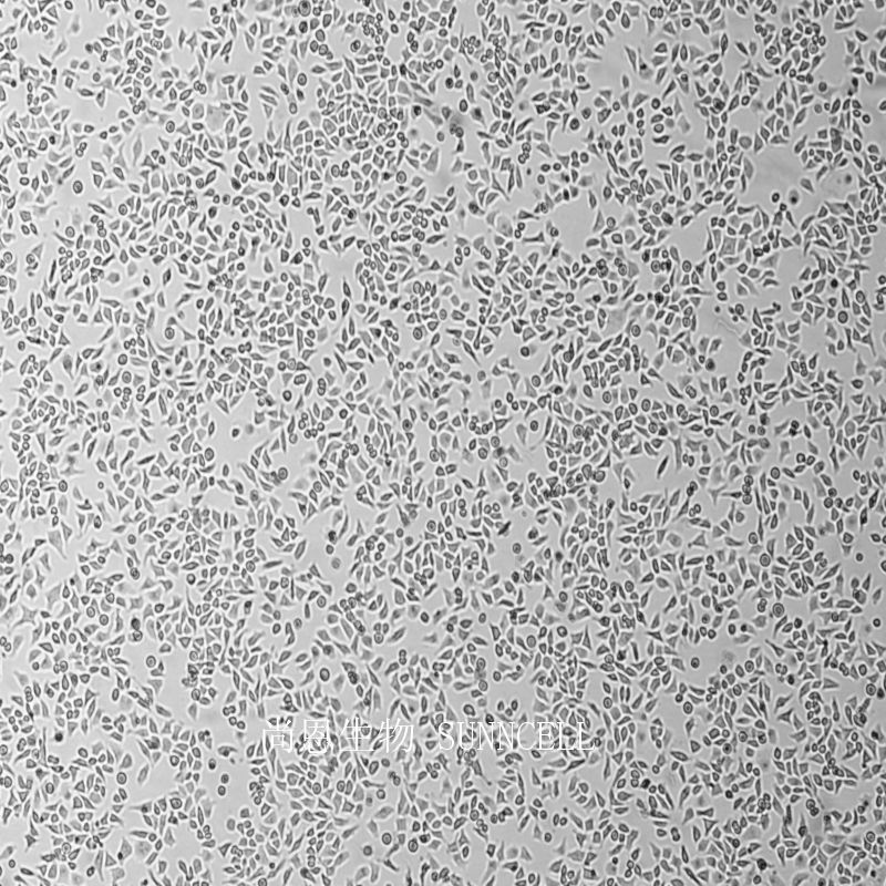 HeLa人宫颈癌细胞