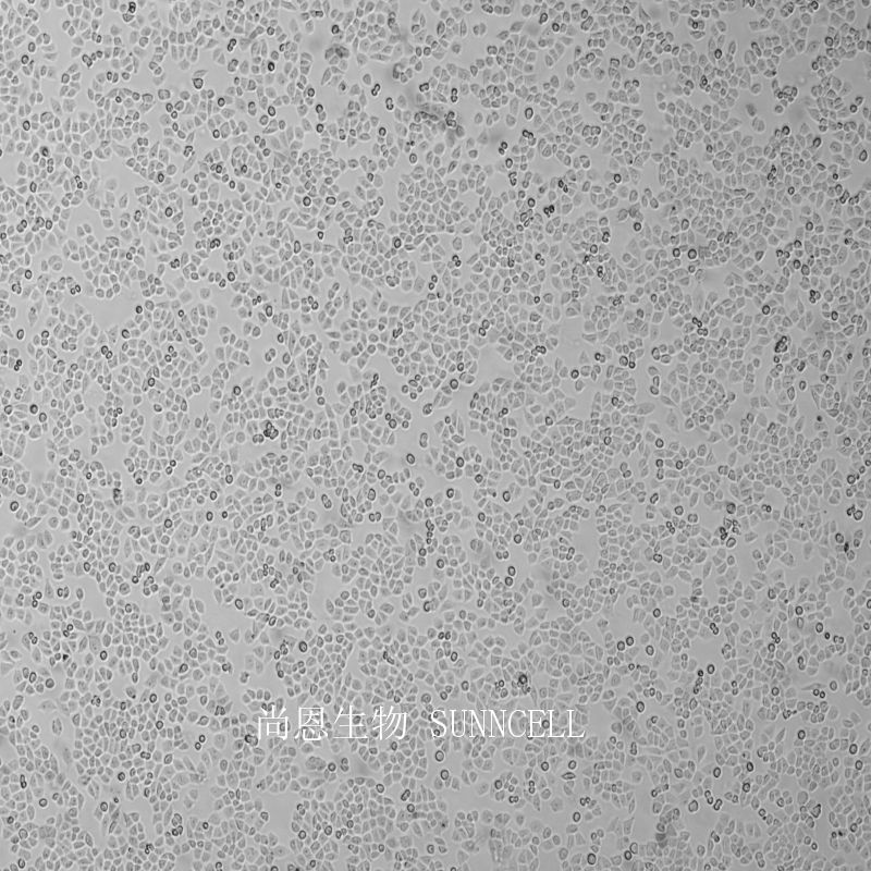 MCF-7人乳腺癌细胞