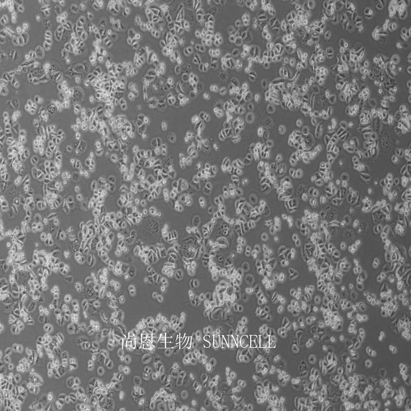 人乳腺腺癌细胞