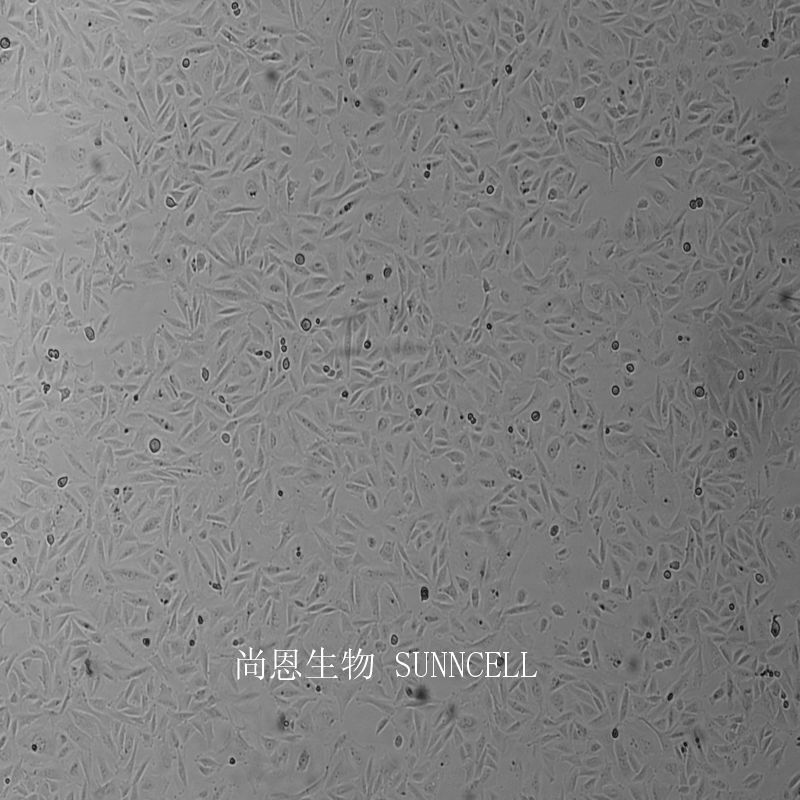 人成骨肉瘤细胞