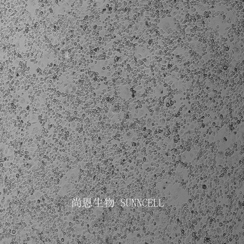 AGS人胃腺癌细胞