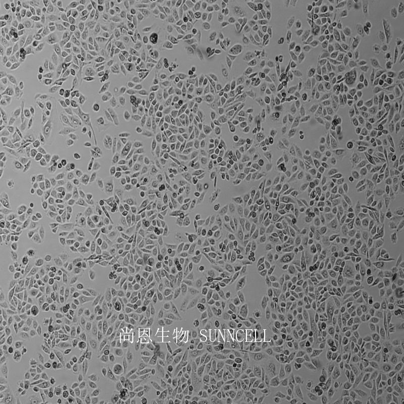 PC-3人前列腺癌细胞