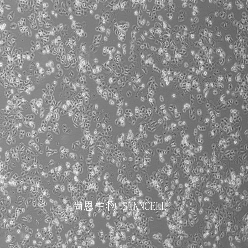 PANC-1人胰腺癌细胞