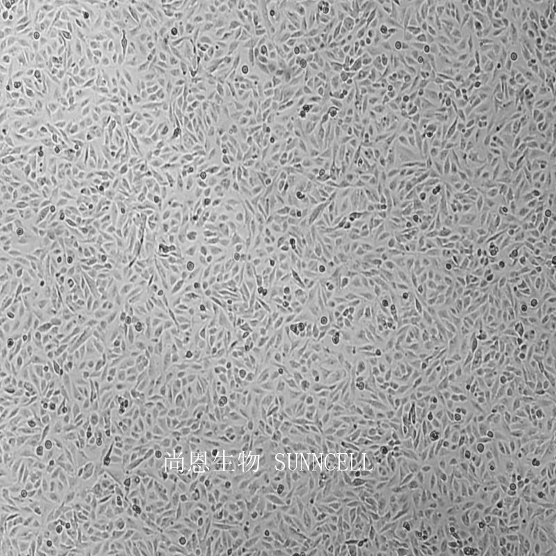 U251人胶质瘤细胞