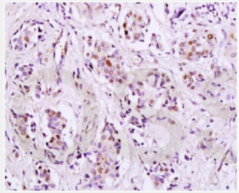 Anti-HPV16 E7 antibody -人乳头瘤病毒16型E7抗体