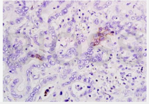 Anti-CCNA2 antibody -周期素A2抗体