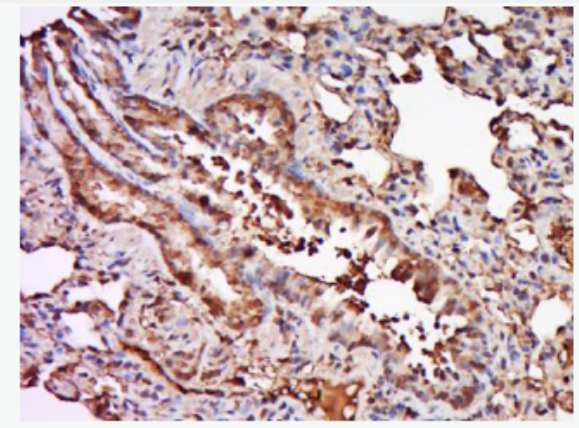 Anti-TRAF6 antibody-肿瘤坏死因子受体相关因子6抗体