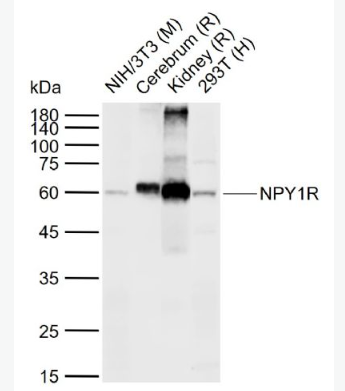 Anti-NPY1R antibody-神经肽Y1受体抗体