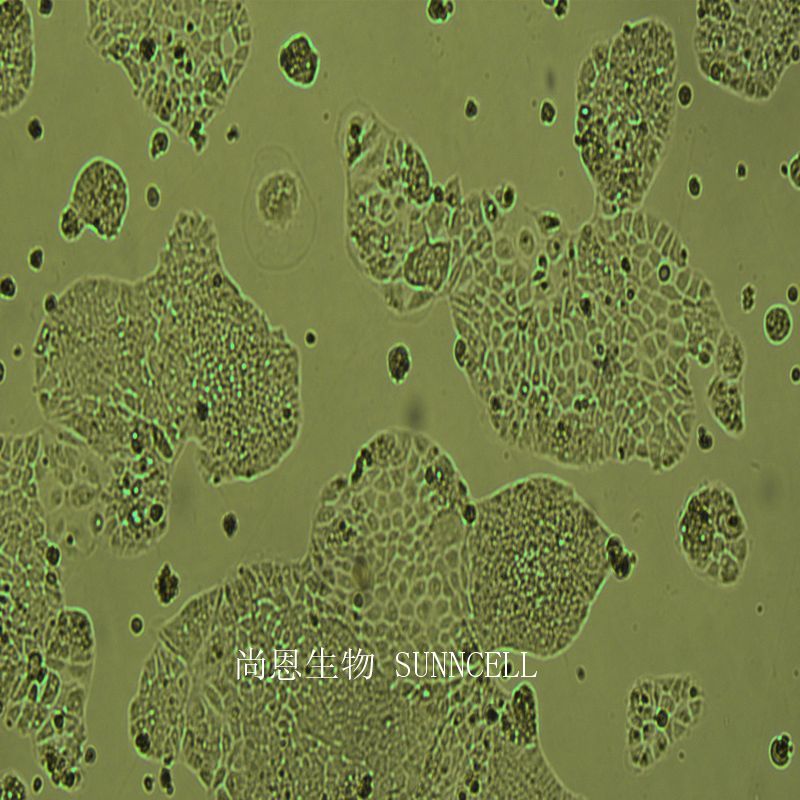 人肝母细胞瘤细胞