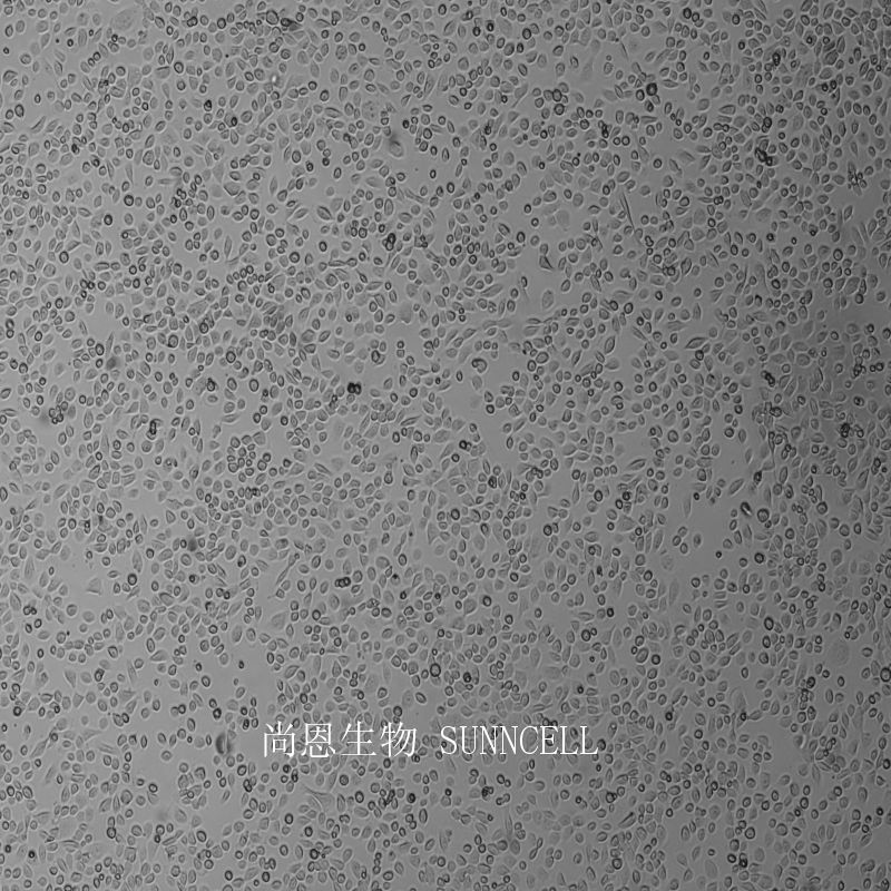 人胆管细胞型肝癌细胞