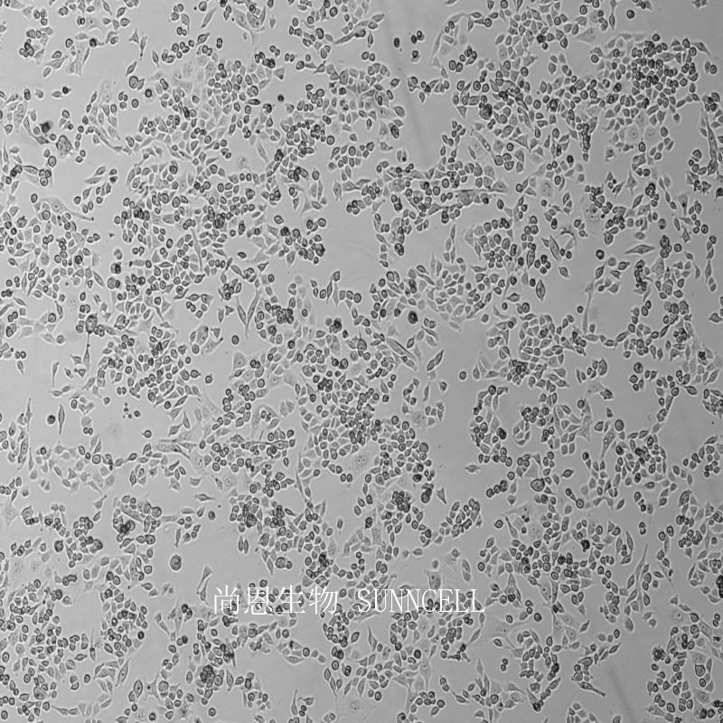 人肾母细胞瘤细胞