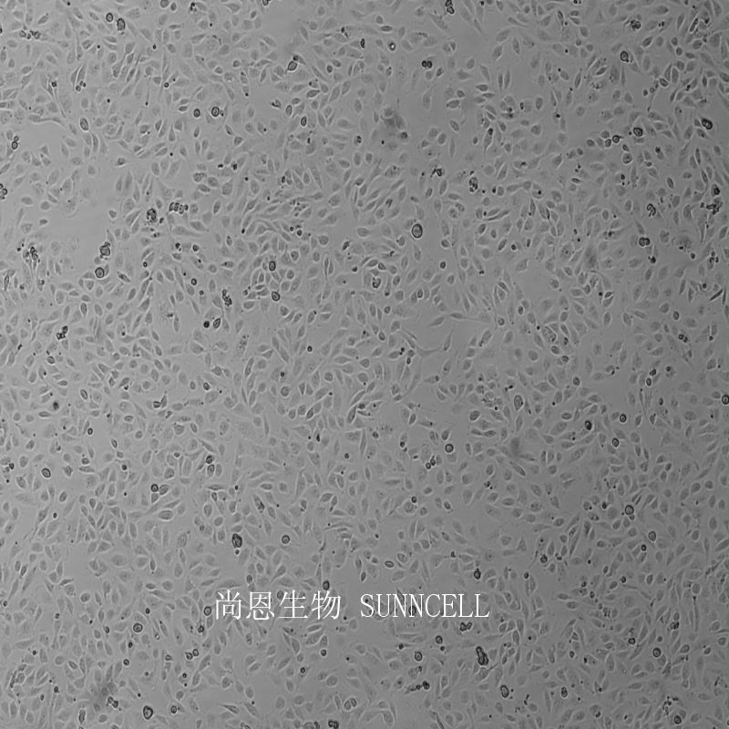 人肾透明细胞腺癌细胞