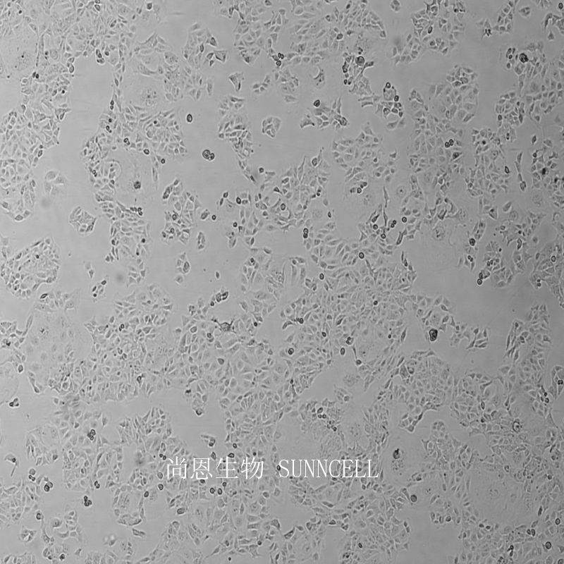 人结直肠腺癌上皮细胞