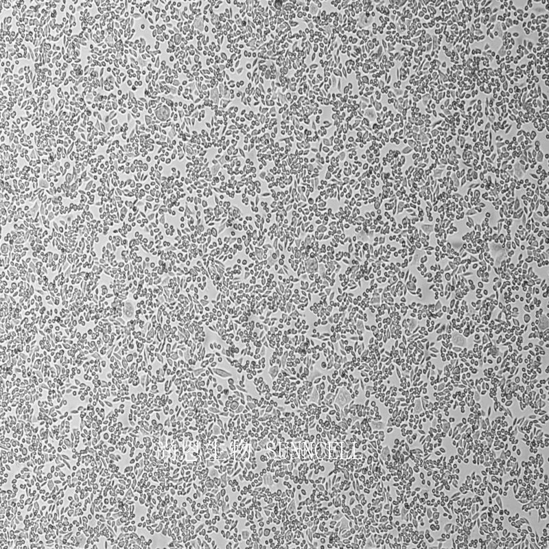 SW620人结肠癌细胞