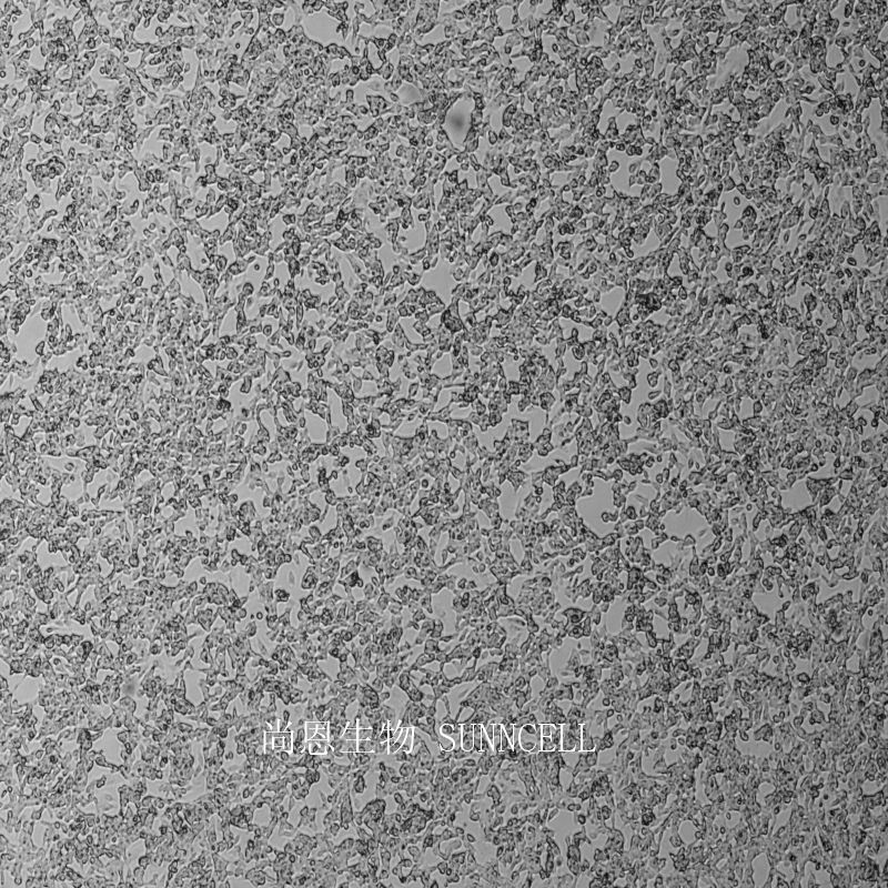 SK-N-BE(2)-C人神经母细胞瘤细胞