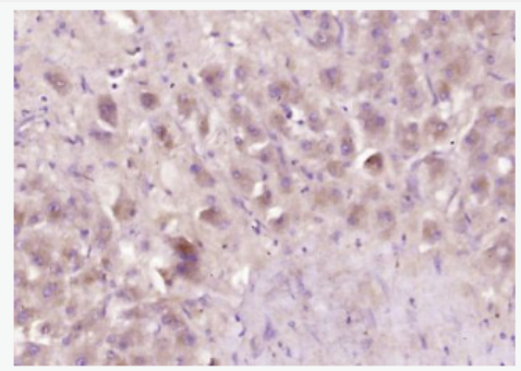 Anti-GSERPINC1  antibody-抗凝血酶3抗体