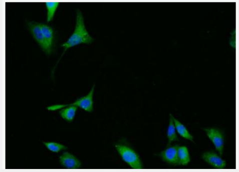 Anti-phospho-ERK1 + 2 (Thr183/Tyr185) antibody-肝细胞生长因子α抗体