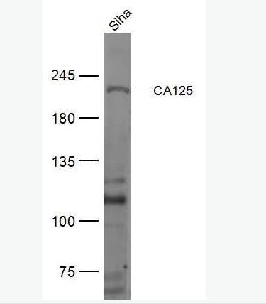 Anti-CA125 antibody-卵巢癌抗原抗体