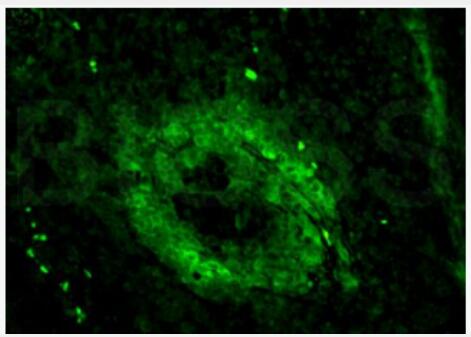 Anti-CD3E antibody-CD3/CD3-ε 抗体