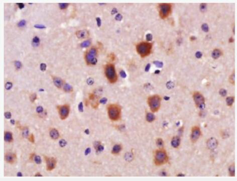 Anti-AR/Androgen receptor antibody-雄激素受体（AR）抗体