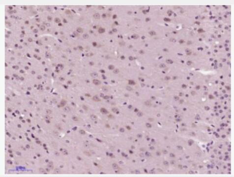 Anti-SNAP25 antibody-突触相关蛋白25抗体