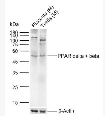 Anti-PPAR delta + beta  antibody-D型-过氧化酶活化增生受体抗体
