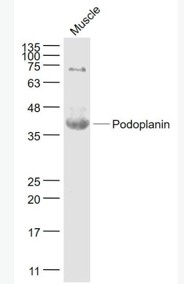 Anti-Podoplanin antibody-平足蛋白/淋巴管内皮细胞蛋白抗体