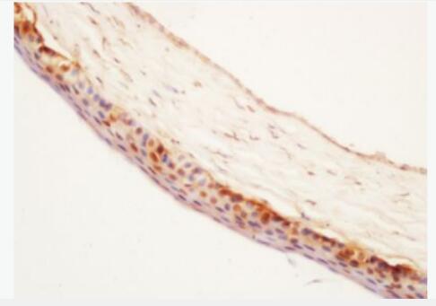 Anti-PEDF antibody-色素上皮源性因子抗体