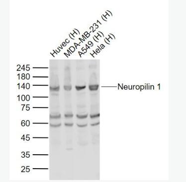 Anti-Neuropilin 1 antibody-神经纤毛蛋白1抗体