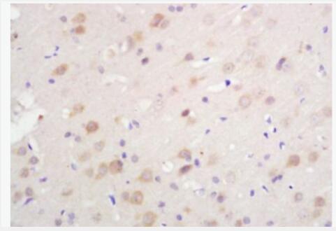 Anti-S100A1  antibody-S100A1抗体