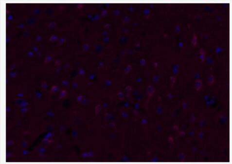 Anti-VIP antibody-肝血管活性肠肽抗体