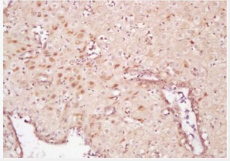 Anti-IKK beta  antibody-KB抑制蛋白激酶β抗体