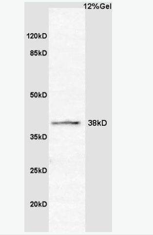Anti-CCNG2 antibody-周期素G2抗体