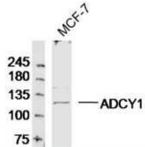 Anti-Adenylate cyclase 1 antibody-腺苷酸环化酶1抗体