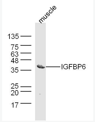 Anti-IGFBP6  antibody-胰岛素样生长因子结合蛋白6抗体