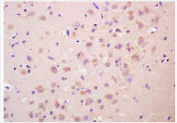 Anti-SECTM1  antibody-分泌和跨膜蛋白1抗体