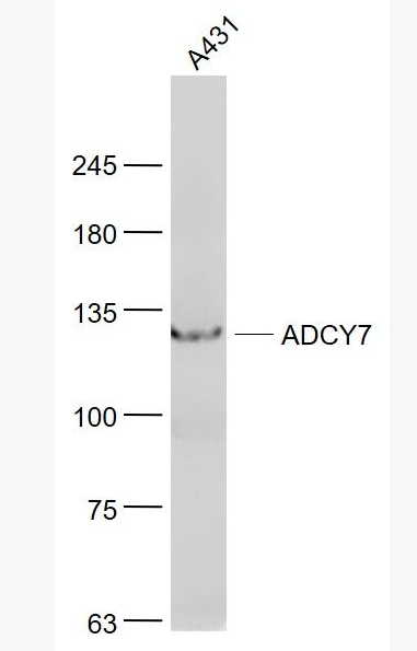 Anti-ADCY7  antibody-腺苷酸环化酶7抗体