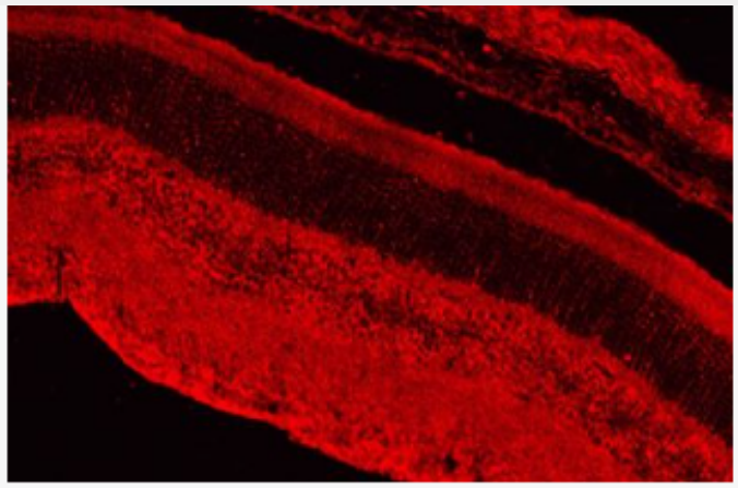 Anti-CAMTA1 antibody-钙调蛋白结合转录激活因子1抗体