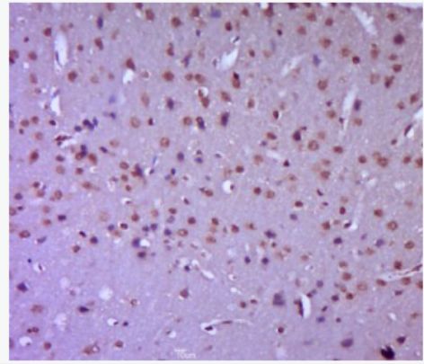 Anti-Plzf  antibody-早幼粒细胞白血病锌指蛋白抗体