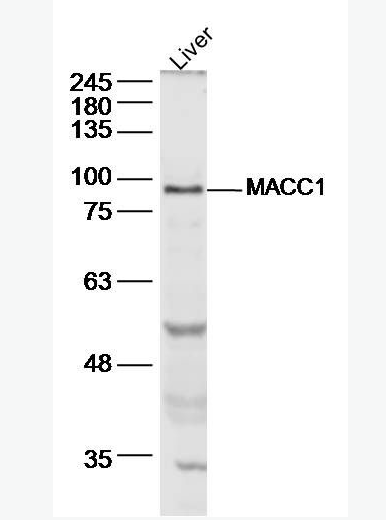 Anti-MACC1  antibody-结肠癌转移相关蛋白1抗体